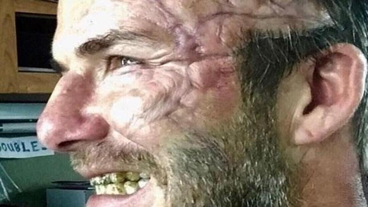 Yıldız futbolcu tanınmaz hale geldi