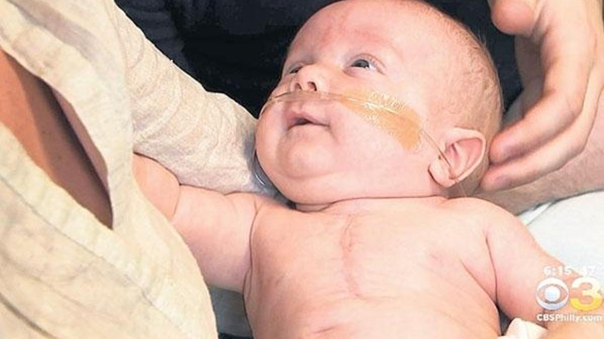 Mucize bebek