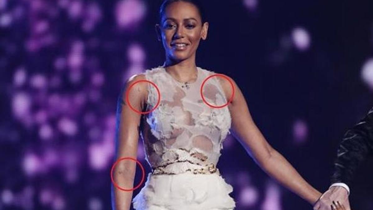 Mel B'yi darp ettiği ortaya çıktı!