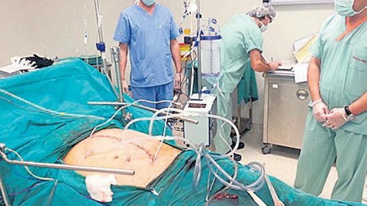 İlerlemiş kansere sıcak kemoterapi