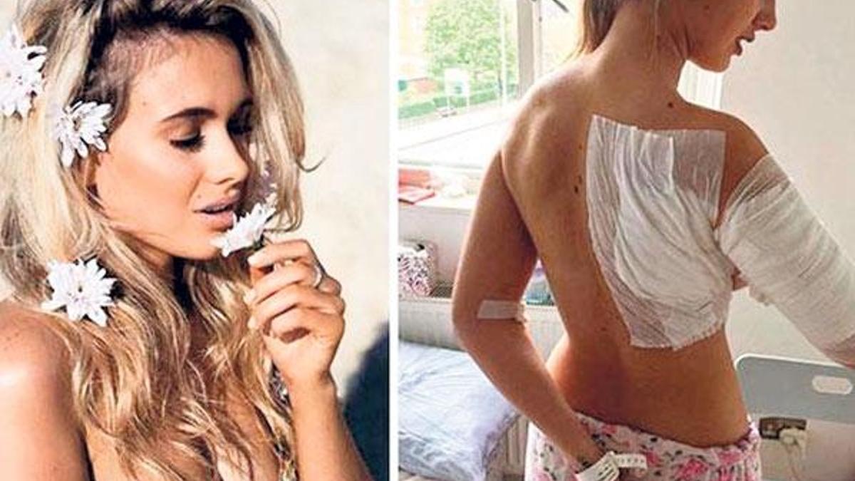 Ünlü model asitli saldırıda yaralandı