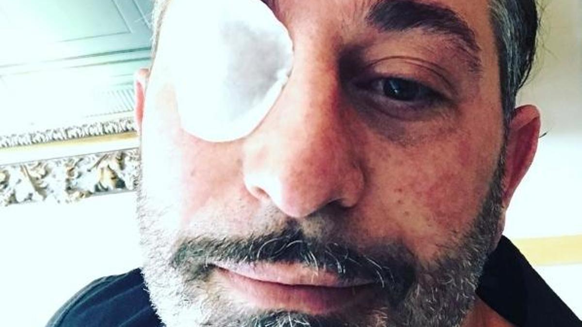 Cem Yılmaz'ın gözüne ne oldu?