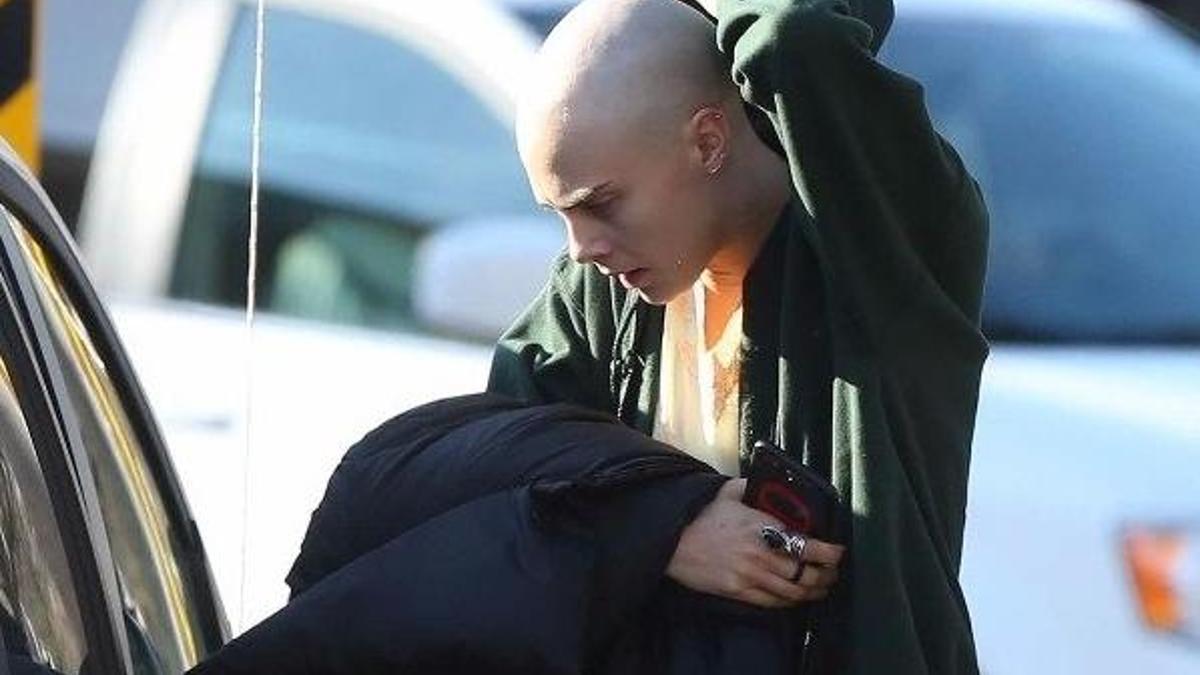 Cara Delevingne son haliyle şoke etti!