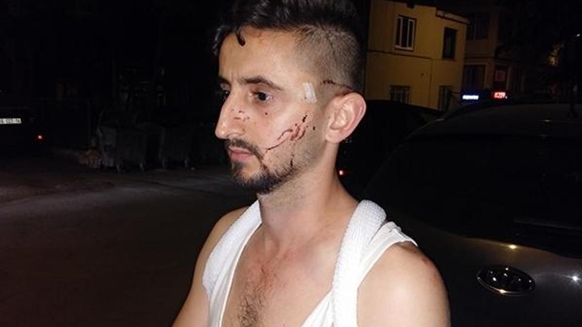 Otobüs şoförü tartıştığı genci çekiçle dövdü