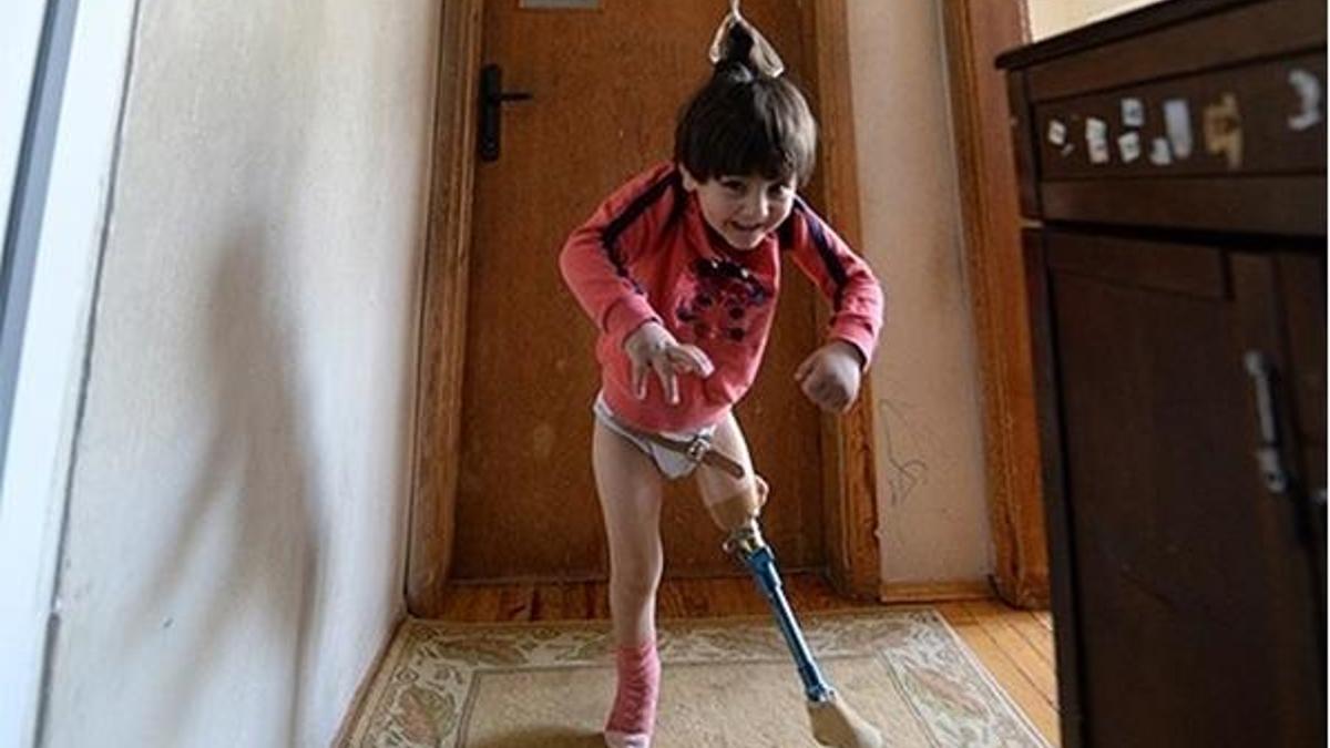 150 liralık düzenekle yürümeyi öğrendi!