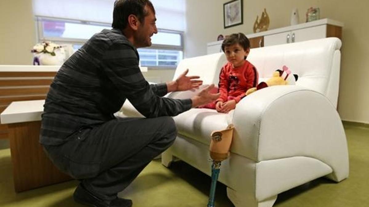 Özge bebekten iyi haber! Protez takılacak
