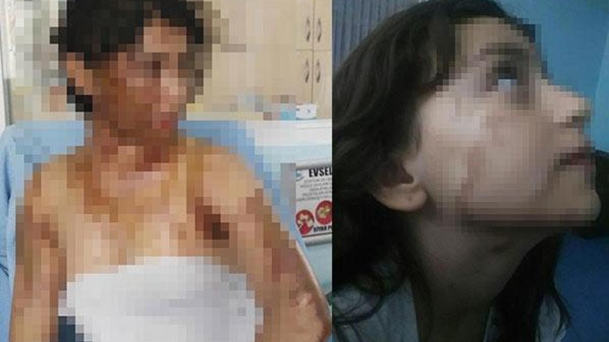 Uyuyan hala ve yeğenine asitli saldırı
