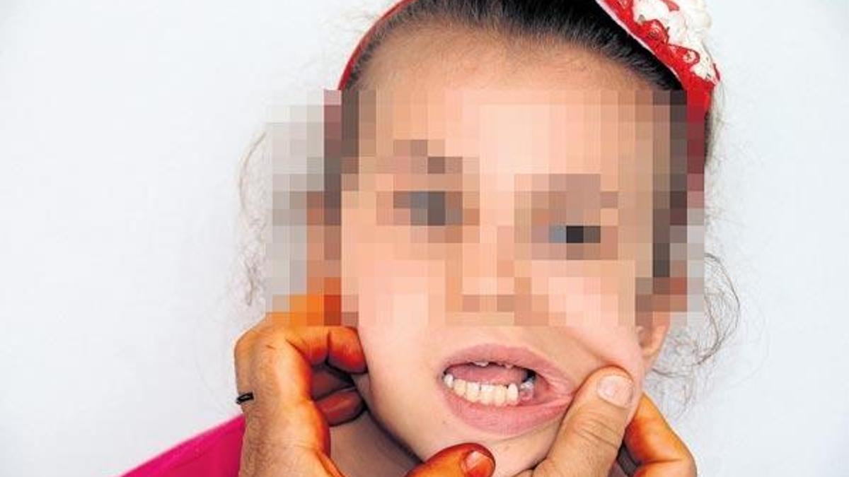 Verdiği ödevi yapmadı öğretmen dişini kırdı