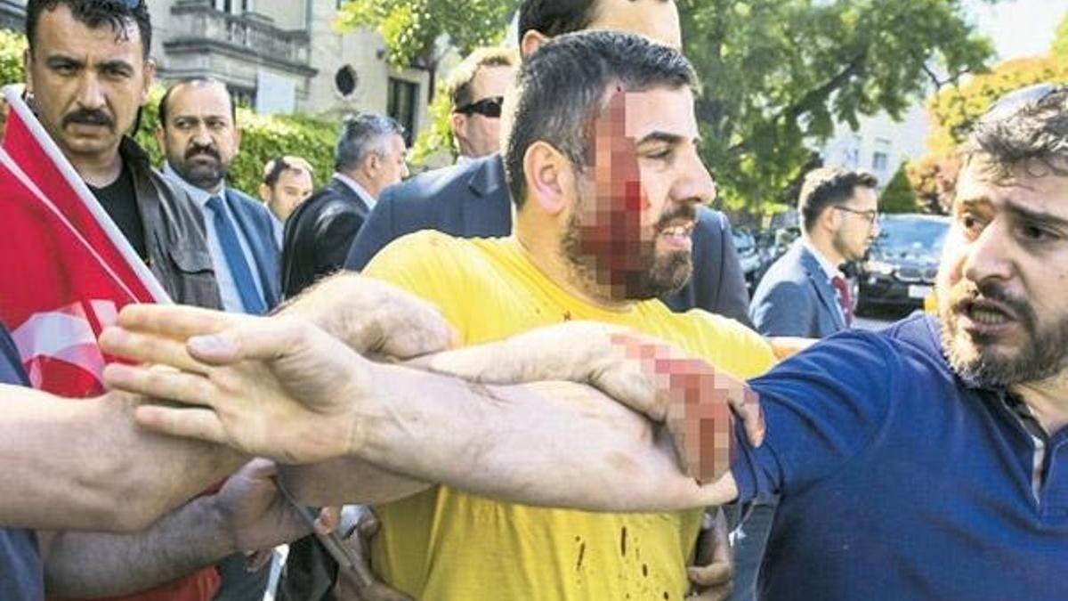‘ABD polisi bir ambulans çağırmadı’
