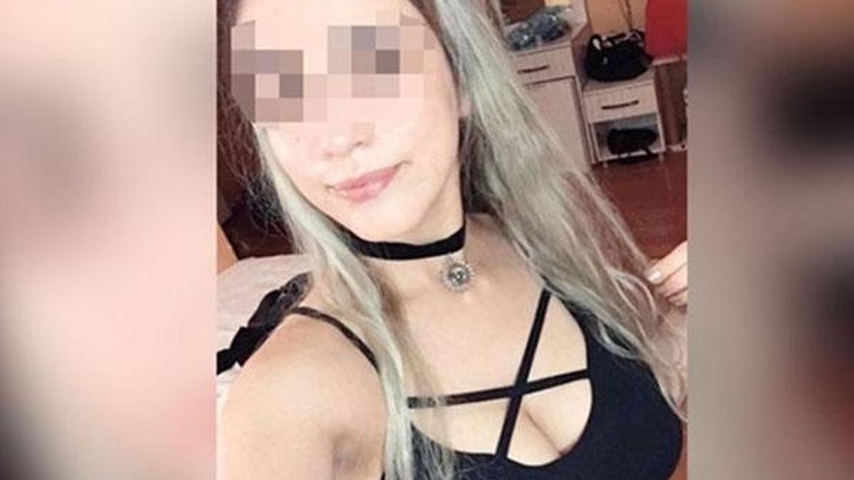 Lazer epilasyonda ‘Frida’sını kaybetti