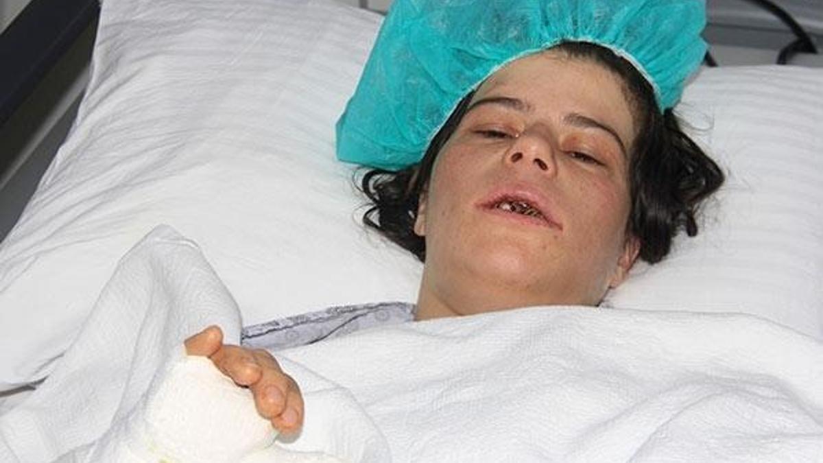 Suriyeli kadını, eşi levyeyle dövüp, kerpetenle dişlerini söktü