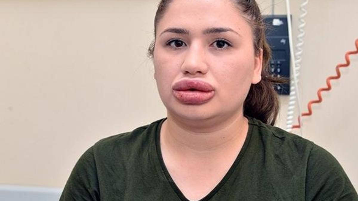 "Sahte estetikçi" kuaföre 5 yıla kadar hapis istemi