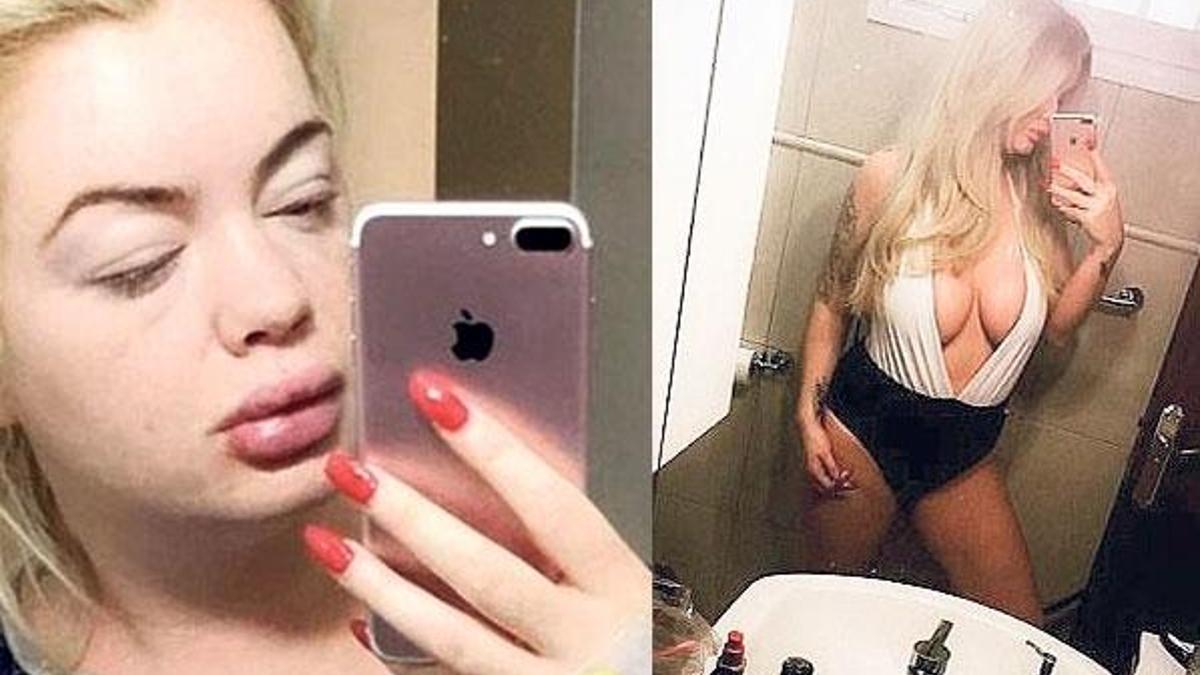 Loto milyoneri Türkiye’de bu hale geldi