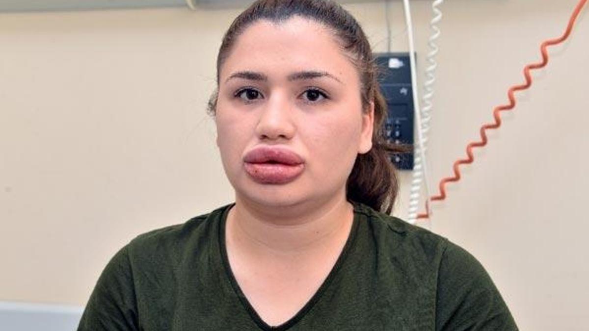 Sahte estetikçiden mağdur hemşireye şok suçlama!