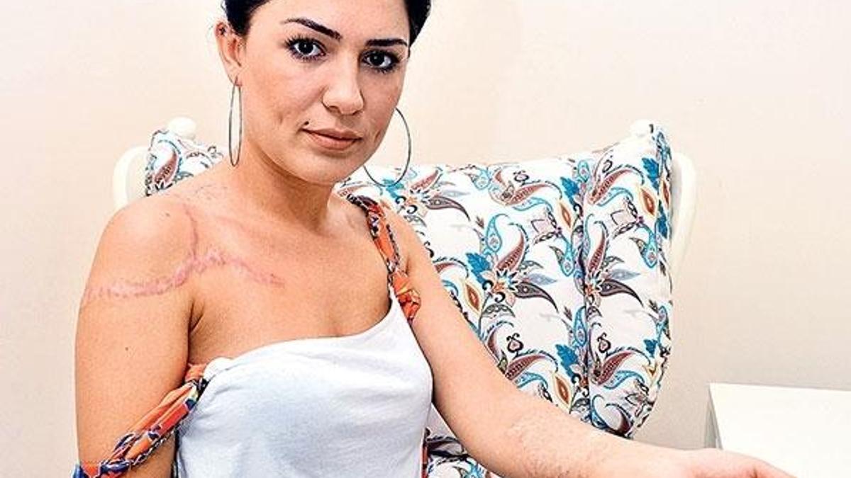 Dövmelerim değil güzelliğim gitti