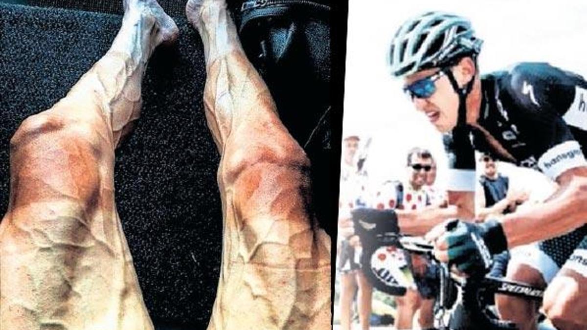 Bir bisikletçinin 2 bin 800 kilometreden sonra bacağı!