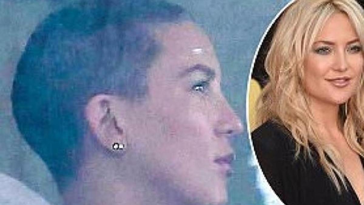 Kate Hudson bu hale geldi!