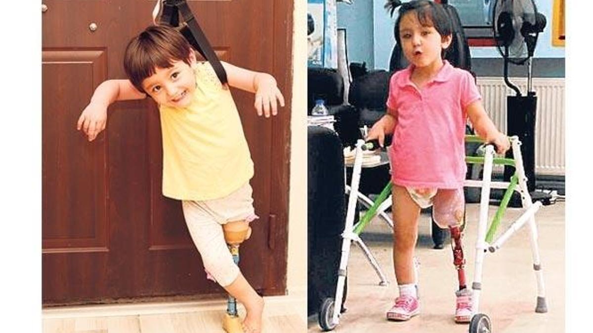 14 bin liralık protezle dünyalar onun oldu
