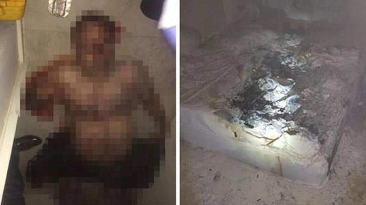 Önce dövdü, sonra yakmak istedi