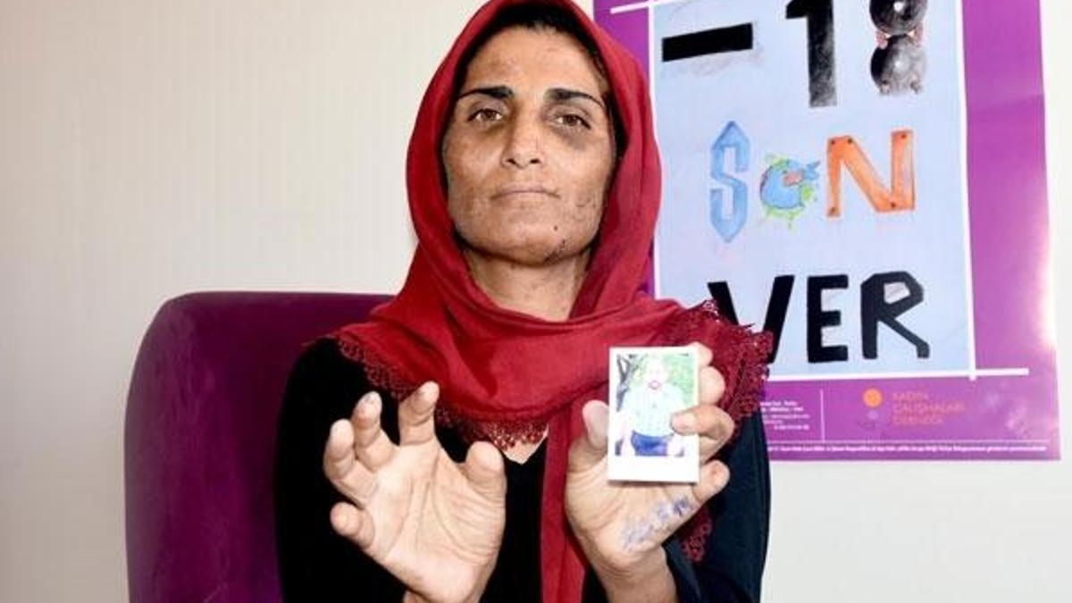 17 yıl boyunca eşinden şiddet gördü! 11 parmağı kesildi...