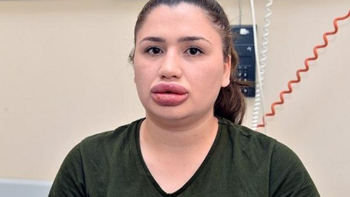 Adana'daki "sahte estetikçi" kuaför cezaevinden kaçtı