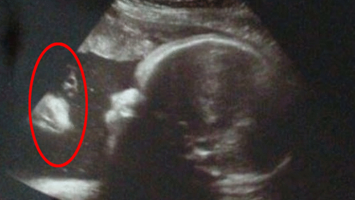 Ultrasonda 'Hz. İsa silüeti'