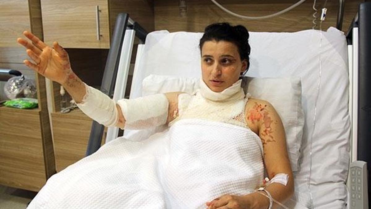 Çayı ısıtmak için yaktıkları jel patlayınca anne ve kızı yandı