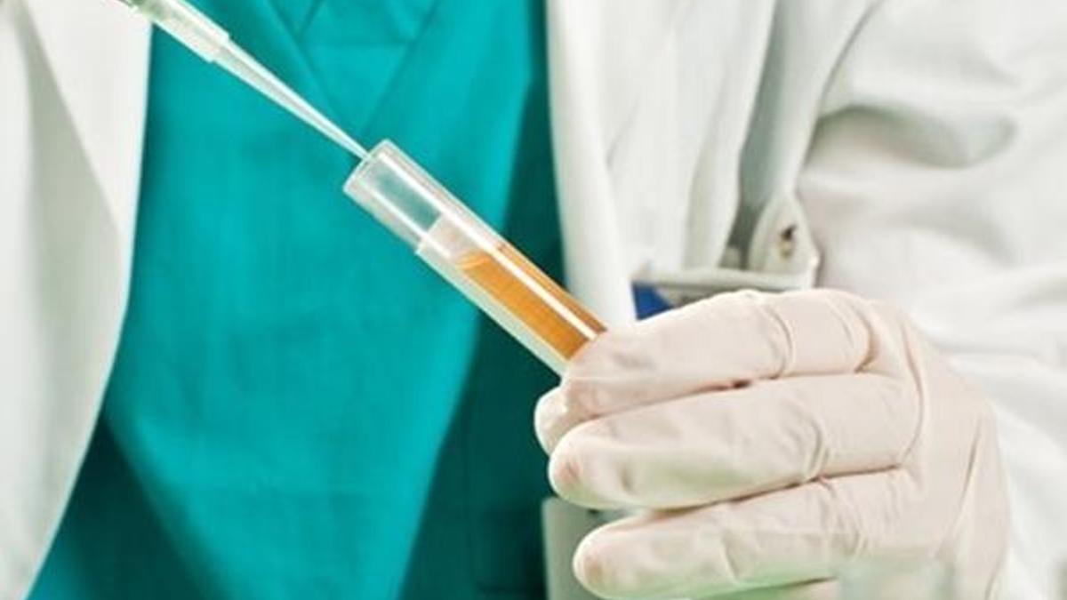 Prostat kanseri tedavisinde "akıllı molekül" avantajı!