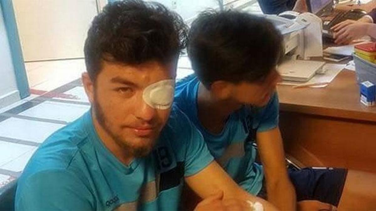 Takım otobüsüne taşlı saldırıda 5 futbolcu yaralandı