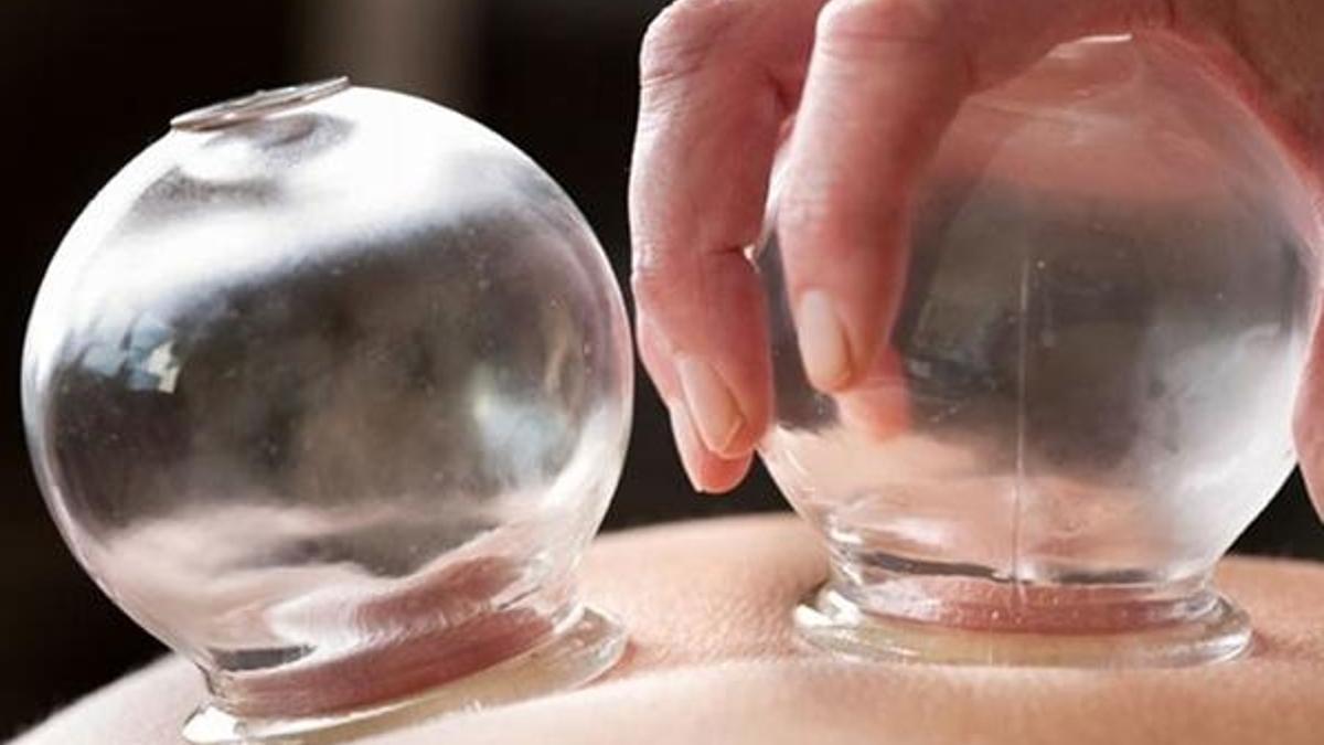 Devletten doktorlara sülük ve hacamat eğitimi