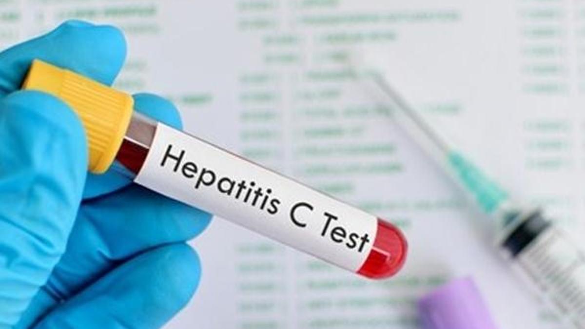 'Herkes mutlaka Hepatit C testi yaptırmalı'