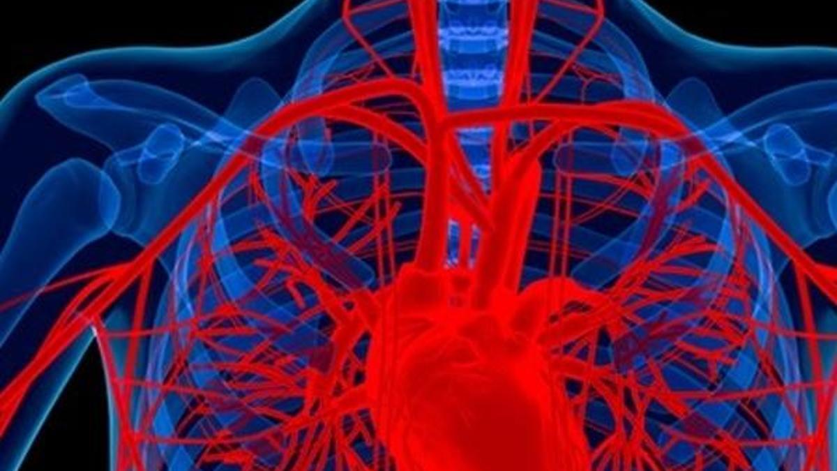 En sinsi öldüren hastalık: Aort anevrizması