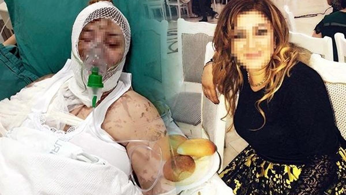 Savcı itiraz etti, kezzaplı saldırgan gözaltına alındı