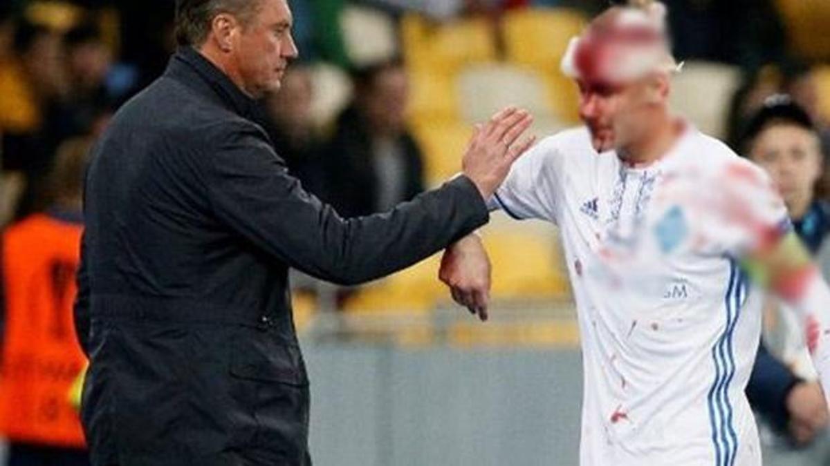 Dynamo Kiev’den Vida açıklaması