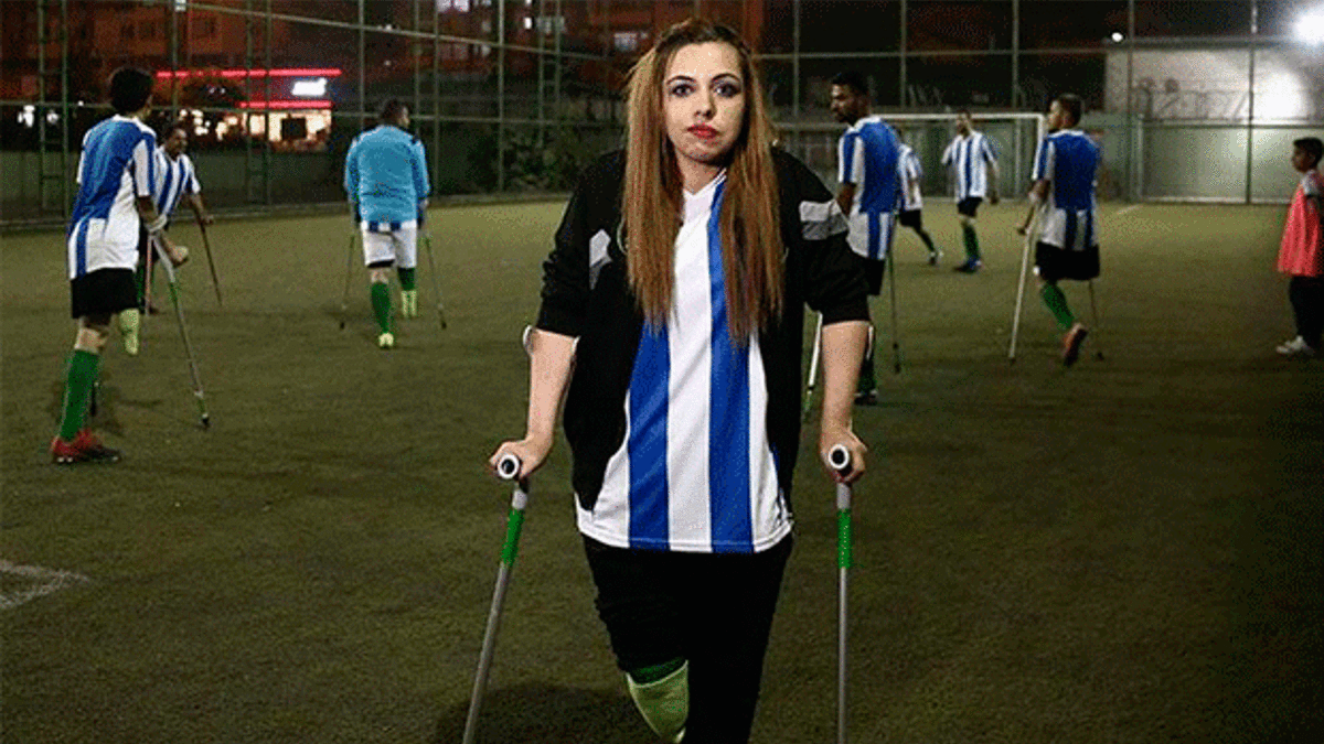 Hayali amputede ilk kadın futbolcu olmak!