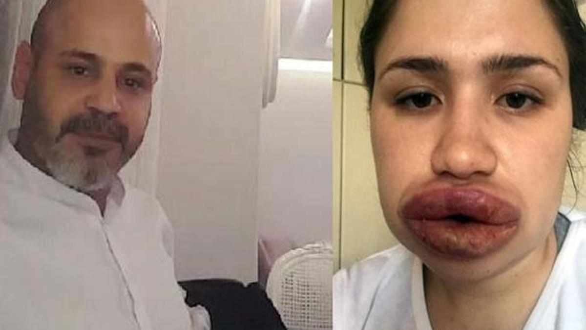 Sahte estetikçi kuaförün cezası belli oldu!