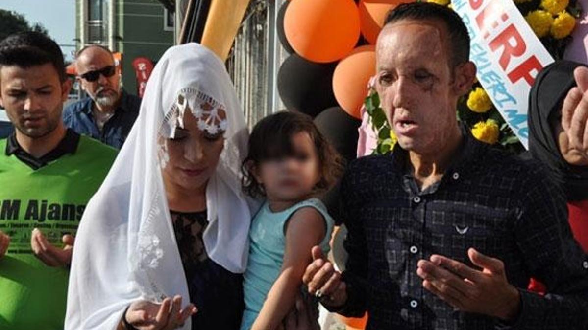 Yüz nakilli Recep Sert, bin 500 lira borcunu ödemeyince tutuklandı