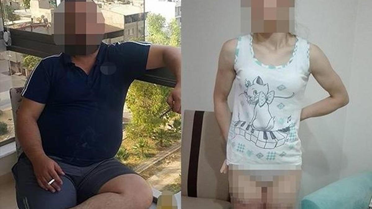 14 yıllık eşinin oklavayla kemiklerini kırdı
