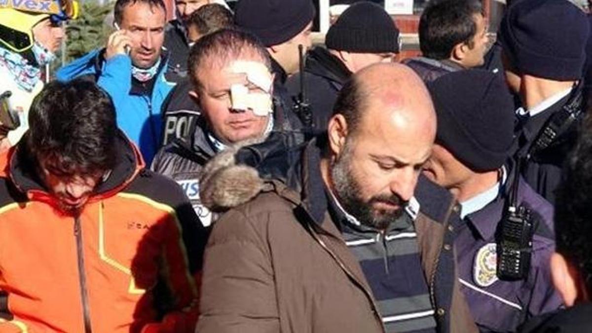 Milli Takım seçmelerinde kavga! 2 yaralı