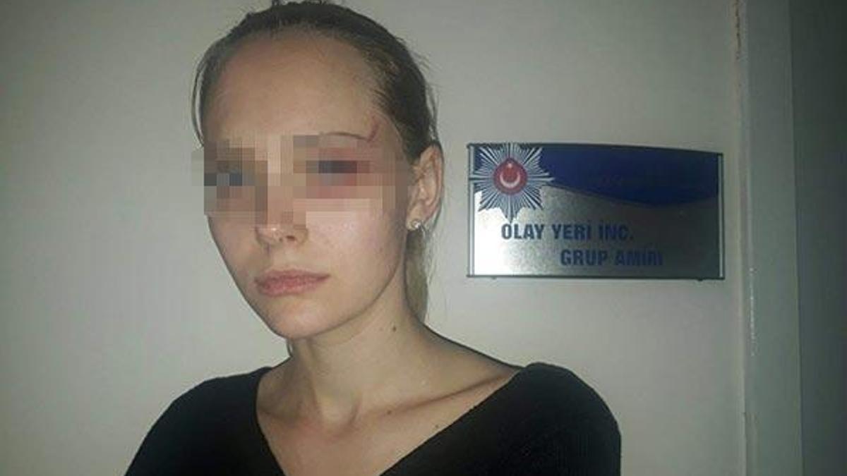 Ukraynalı mankenden tecavüz ve darp iddiası