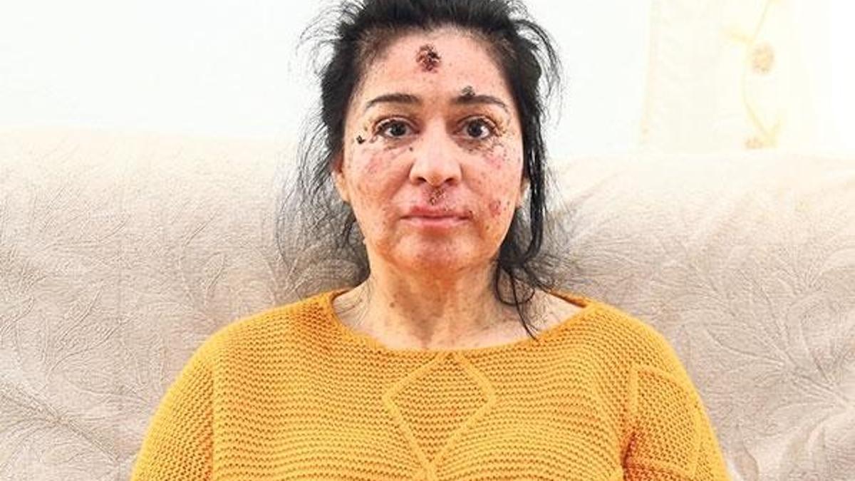 Tıp çaresiz kaldı, mucize bekliyor, yardım istiyor