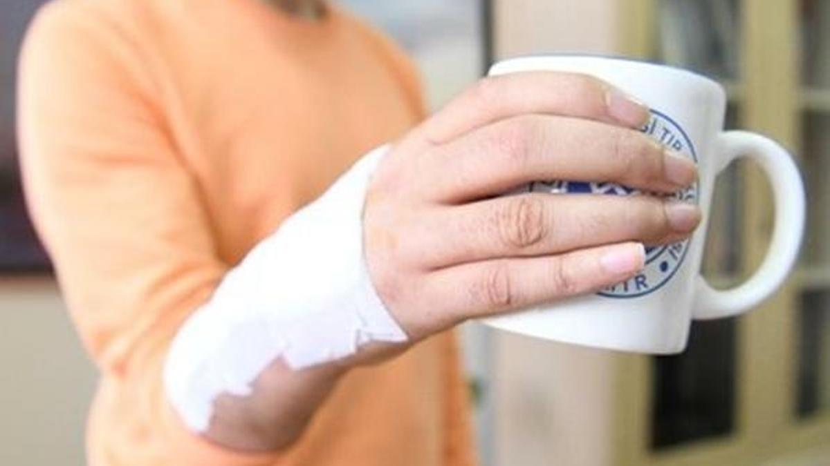 Ege Üniversitesi'nde el bileği protezi geliştirildi!