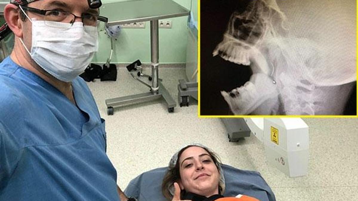 18 yıl sonra fark edilip çıkarıldı!