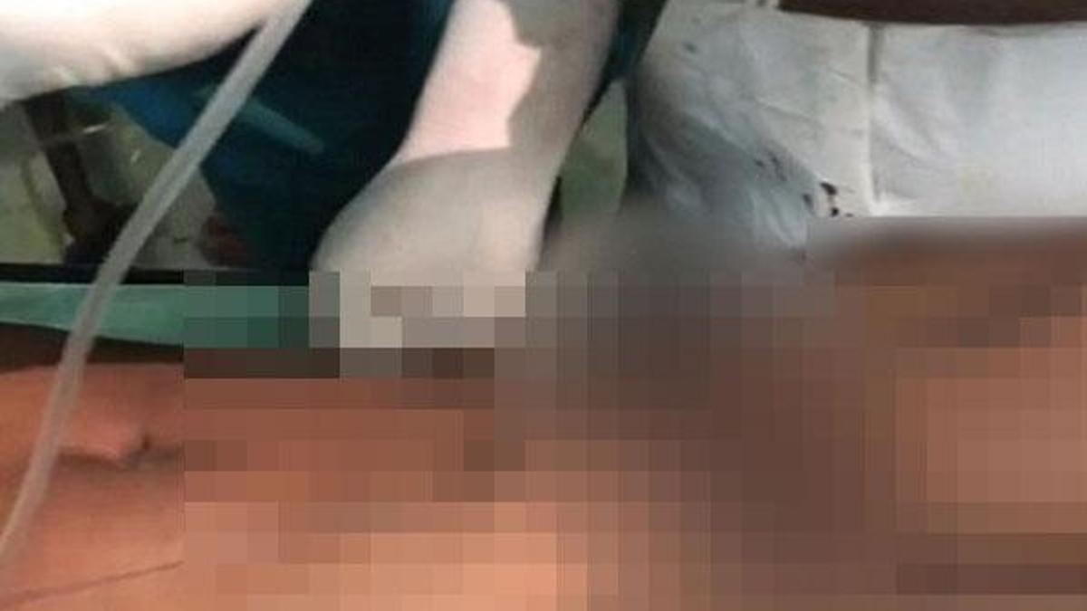 Akılalmaz görüntü! 130 cm'lik demir çubuk testisinden girip...