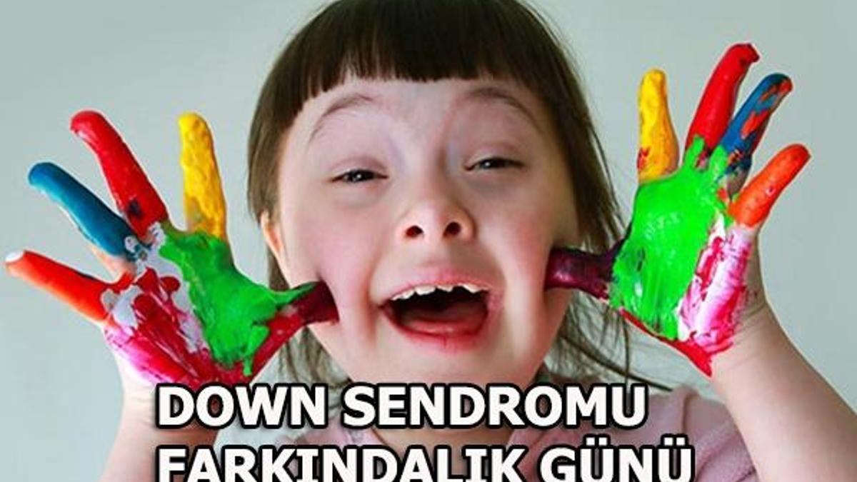 Down Sendromu Farkındalık Günü nedir? Down Sendromu belirtileri nelerdir?