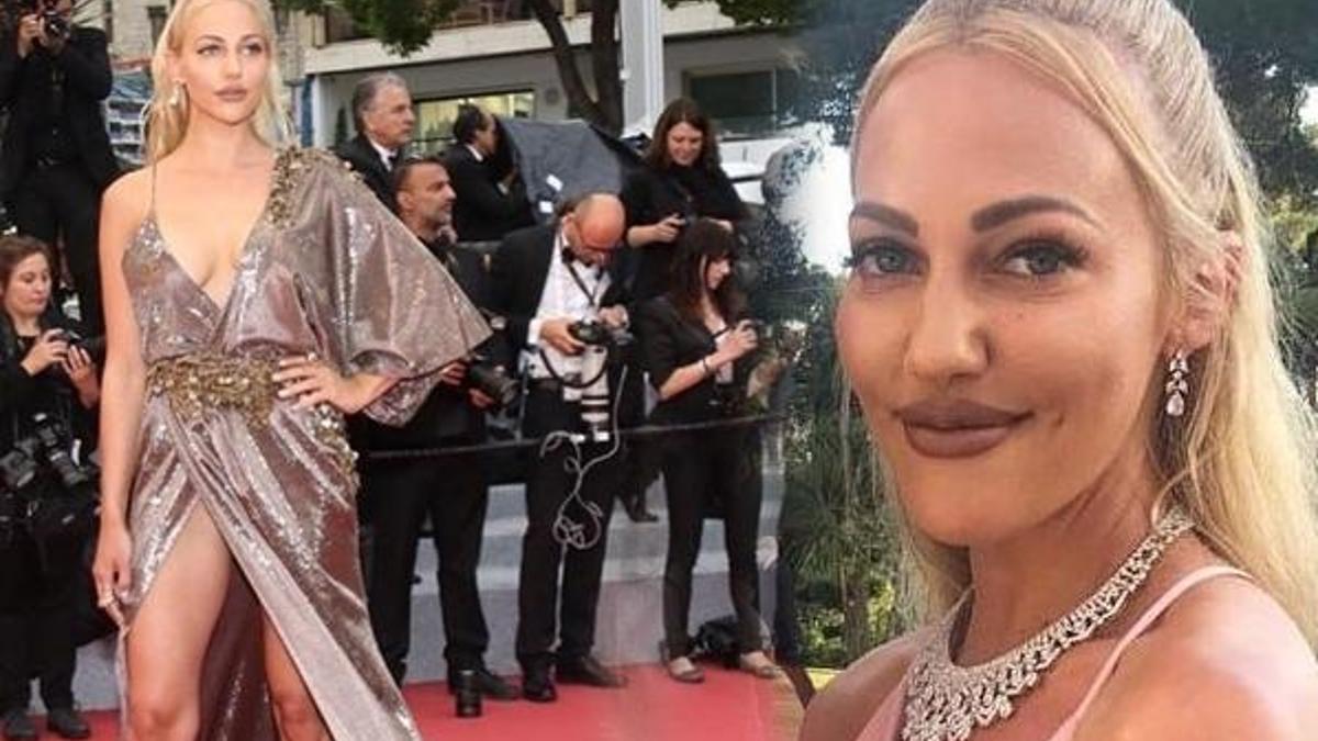 Meryem Uzerli, yüzüne yaptırtığı dolgularla alay konusu oldu
