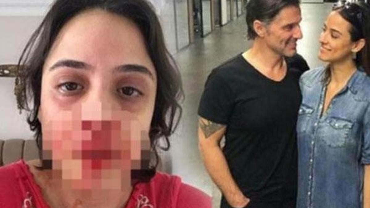 Hazım Körmükçü, spiker nişanlısını bu hale getirdi