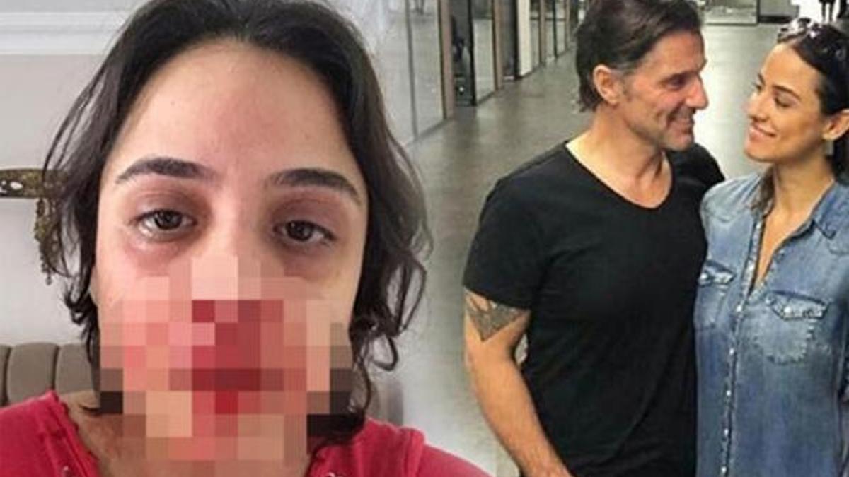 Darp olayından sonra flaş iddia!