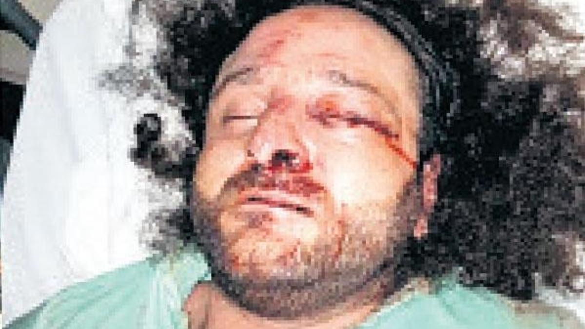 Gece kulübüne sandaletle girmek istedi, dövüldü
