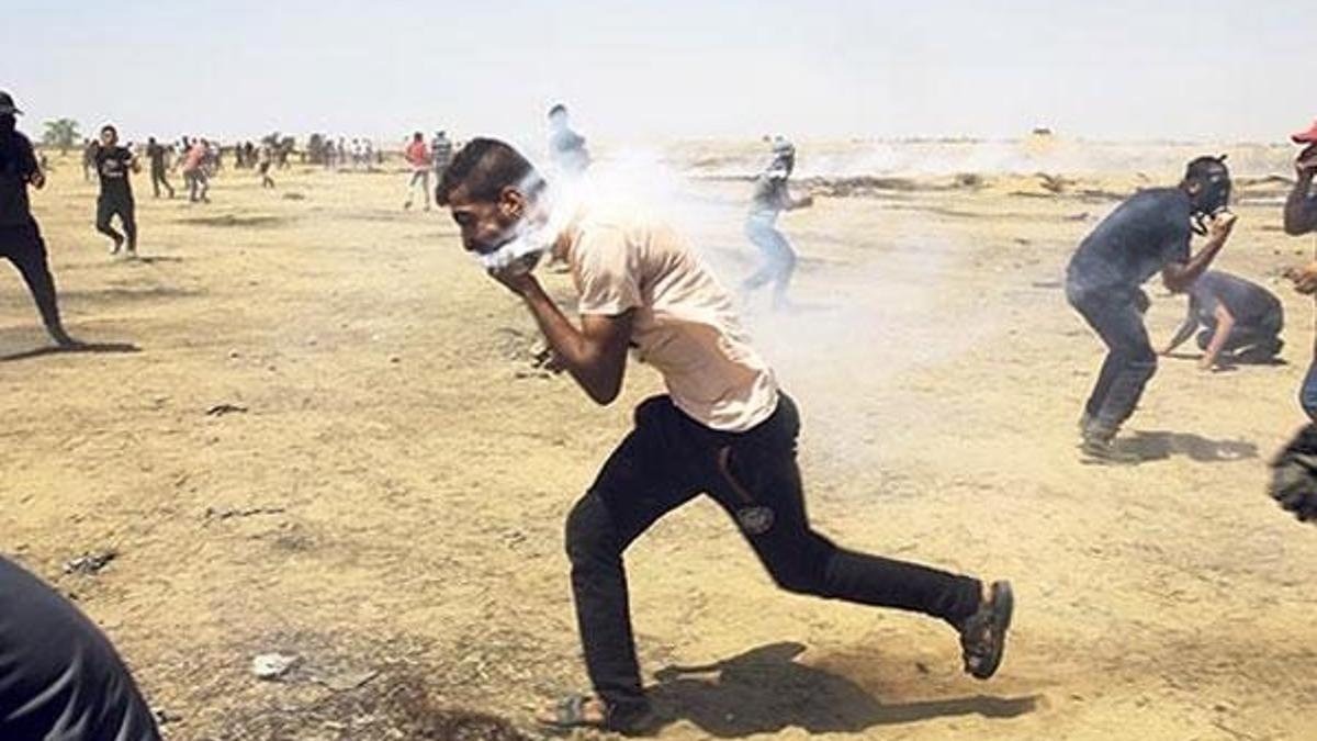 Ağzına gaz bombası isabet eden Filistinli, Gazze'den çıkmayı bekliyor
